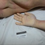 Murdered and stuffed in suitcase