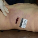 Murdered and stuffed in suitcase