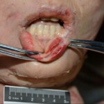 Murdered and stuffed in suitcase