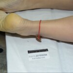 Murdered and stuffed in suitcase