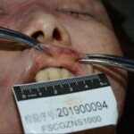 Murdered and stuffed in suitcase