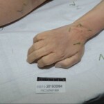 Murdered and stuffed in suitcase