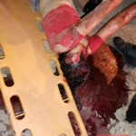 Tragic end of drunken motorcycle crash