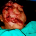 Tragic end of drunken motorcycle crash