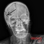 Woman killed by firework during new year celebrations