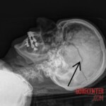 Woman killed by firework during new year celebrations