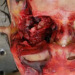 Woman killed by firework during new year celebrations