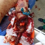 ZOO security guard lost his arm when he tried to pet lion