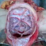 Anatomical autopsy for young medics
