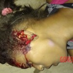 Assassinated female drug user