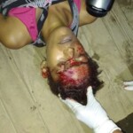 Assassinated female drug user