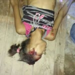 Assassinated female drug user