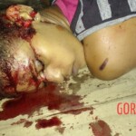 Assassinated female drug user