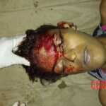 Assassinated female drug user