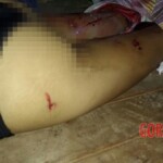 Assassinated female drug user