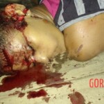 Assassinated female drug user