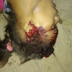 Assassinated female drug user