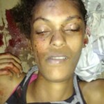 Assassinated female drug user