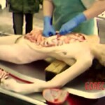 Autopsy photos of marathon runner