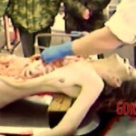 Autopsy photos of marathon runner