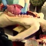 Autopsy photos of marathon runner