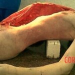 Autopsy photos of marathon runner