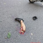 Biker lost both legs and died on spot in collision with car