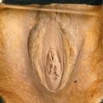Breasts and vaginas in Chinese Forensic Museum