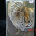 Breasts and vaginas in Chinese Forensic Museum