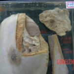 Breasts and vaginas in Chinese Forensic Museum