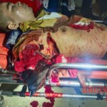 Cambodian guy attacked with machete after wedding