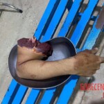 Cambodian guy attacked with machete after wedding