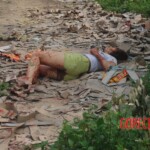 Chinese woman with severed carotid artery