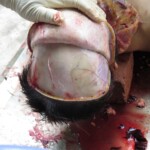 Chinese woman with severed carotid artery