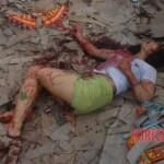 Chinese woman with severed carotid artery