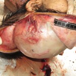 Chinese woman with severed carotid artery