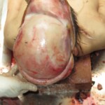 Chinese woman with severed carotid artery