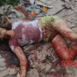 Chinese woman with severed carotid artery