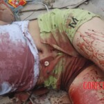 Chinese woman with severed carotid artery