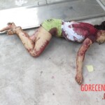 Chinese woman with severed carotid artery