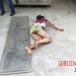 Chinese woman with severed carotid artery