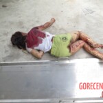 Chinese woman with severed carotid artery