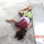 Chinese woman with severed carotid artery