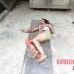 Chinese woman with severed carotid artery