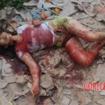 Chinese woman with severed carotid artery