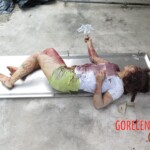 Chinese woman with severed carotid artery