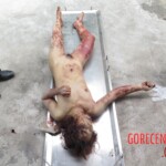 Chinese woman with severed carotid artery