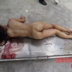 Chinese woman with severed carotid artery