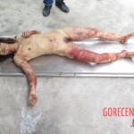 Chinese woman with severed carotid artery