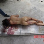 Chinese woman with severed carotid artery